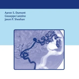 Fri frakt Brain Arteriovenous Malformations and Arteriovenous Fistulas | 0:e upplagan