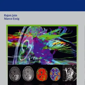 Brain Tumor Imaging | 0:e upplagan Rabatt