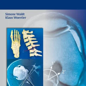 Endast idag Measurements and Classifications in Musculoskeletal Radiology | 0:e upplagan
