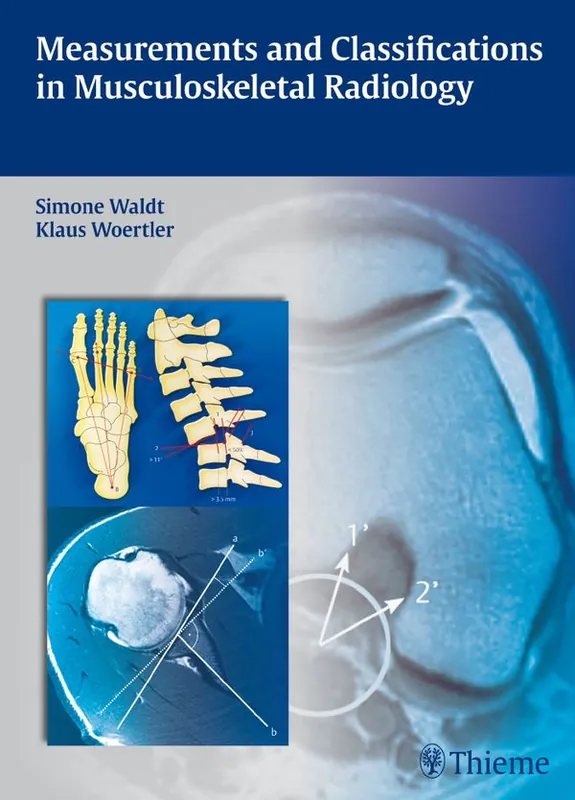 Endast idag Measurements and Classifications in Musculoskeletal Radiology | 0:e upplagan