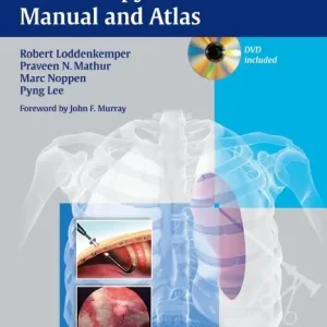 Nedsatt pris Medical Thoracoscopy / Pleuroscopy: Manual and Atlas | 0:e upplagan