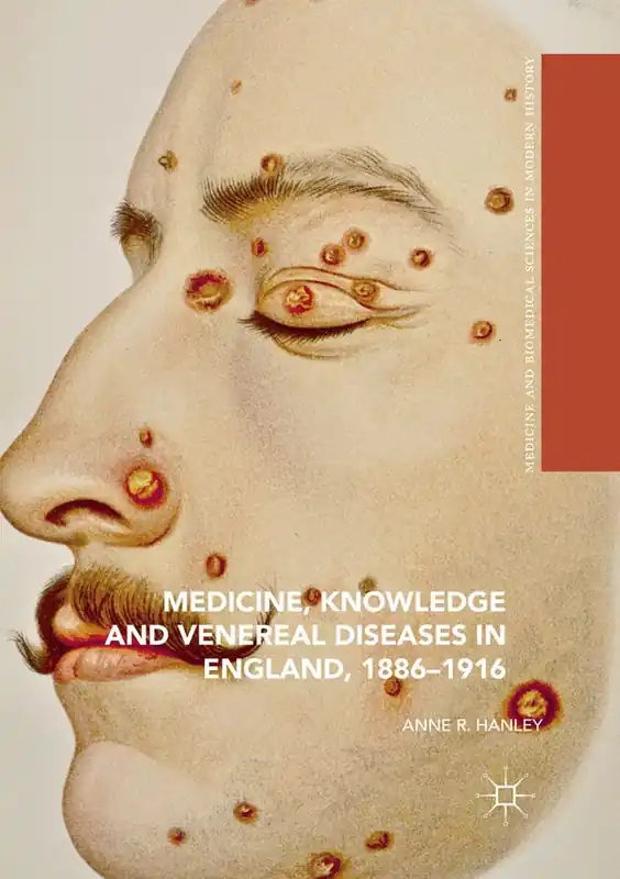 Medicine, Knowledge and Venereal Diseases in England, 1886-1916 | 1:a upplagan Handla nu