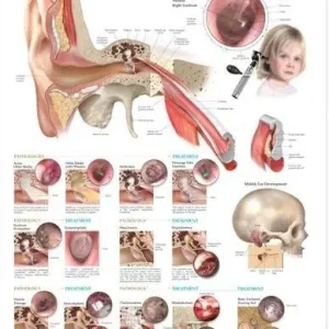 Middle Ear Conditions Anatomical Chart | 0:e upplagan Rabatt