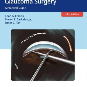 Erbjudande Minimally Invasive Glaucoma Surgery | 0:e upplagan