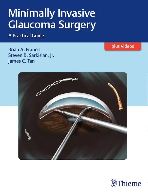 Erbjudande Minimally Invasive Glaucoma Surgery | 0:e upplagan
