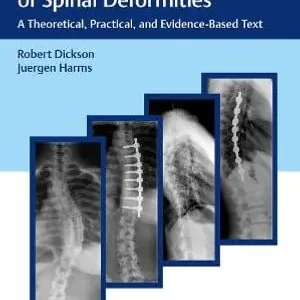 Modern Management of Spinal Deformities | 0:e upplagan Begränsat antal
