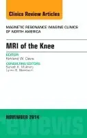 Snabb leverans MRI of the Knee, An Issue of Magnetic Resonance Imaging Clinics of North America | 0:e upplagan