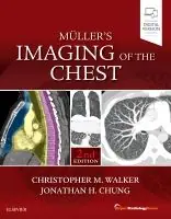 Muller's Imaging of the Chest | 2:a upplagan Billig