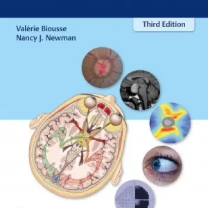 Erbjudande Neuro-Ophthalmology Illustrated | 3:e upplagan