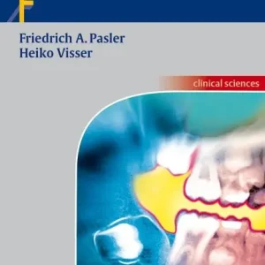 Reapris Pocket Atlas of Dental Radiology | 2:a upplagan