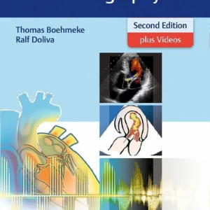 Billigare Pocket Atlas of Echocardiography | 2:a upplagan
