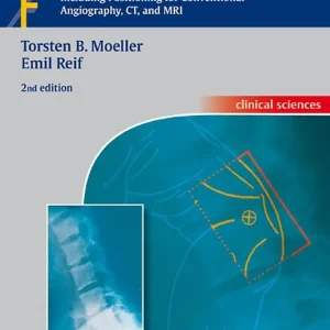Pocket Atlas of Radiographic Positioning | 2:a upplagan Billig