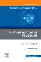 Rabatt Premature Rupture of Membranes, An Issue of Obstetrics and Gynecology Clinics | 0:e upplagan