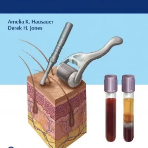 PRP and Microneedling in Aesthetic Medicine | 0:e upplagan Snabb frakt